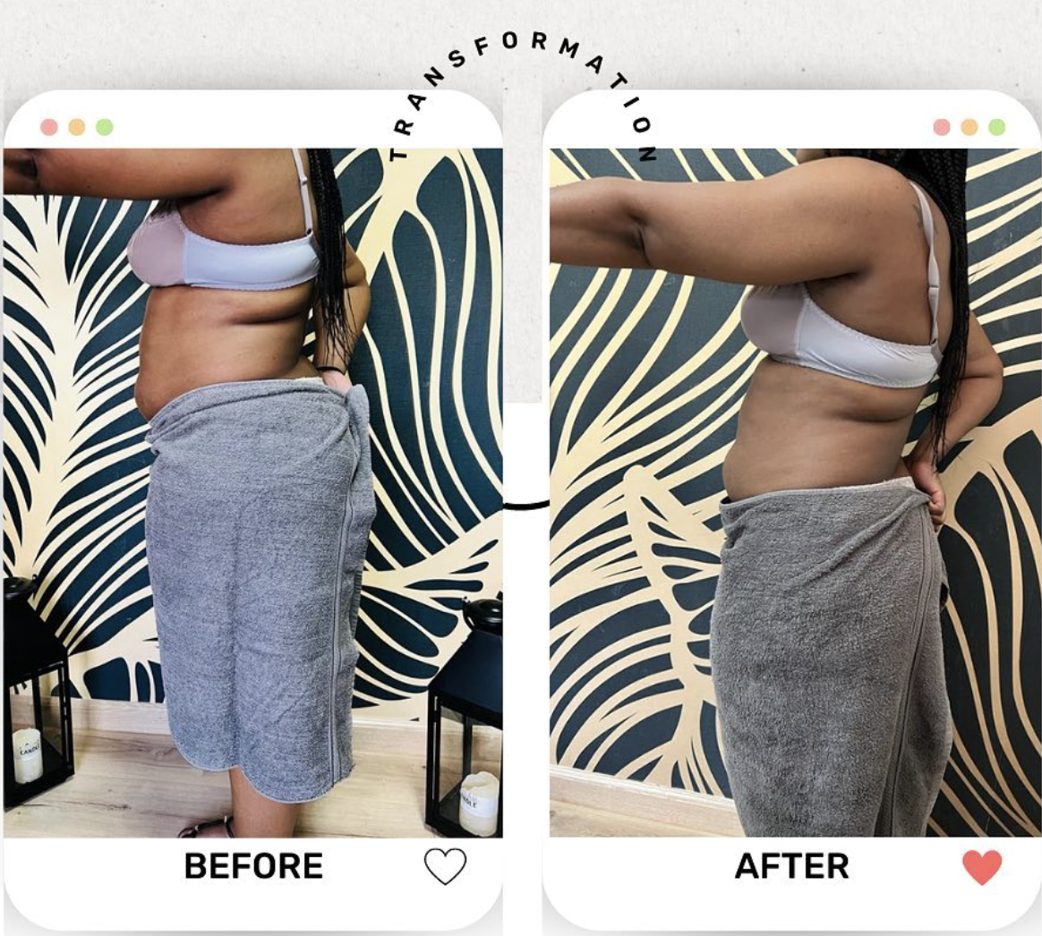 Full Body Contouring