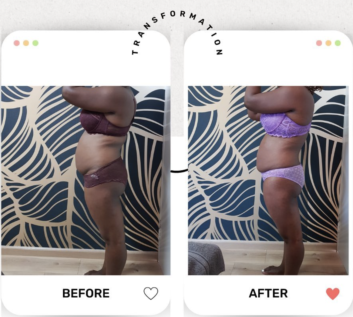 Midsection Transformation