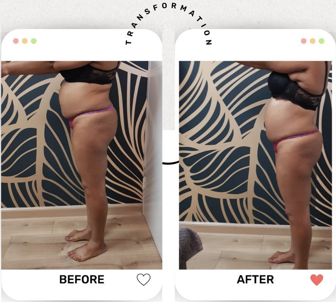 Waist & Hip Sculpting