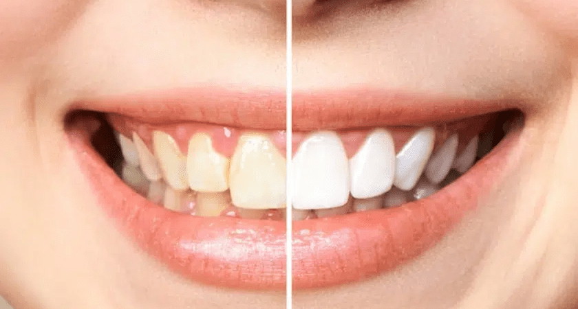 Cosmetic Dentistry