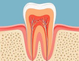 Root Canals