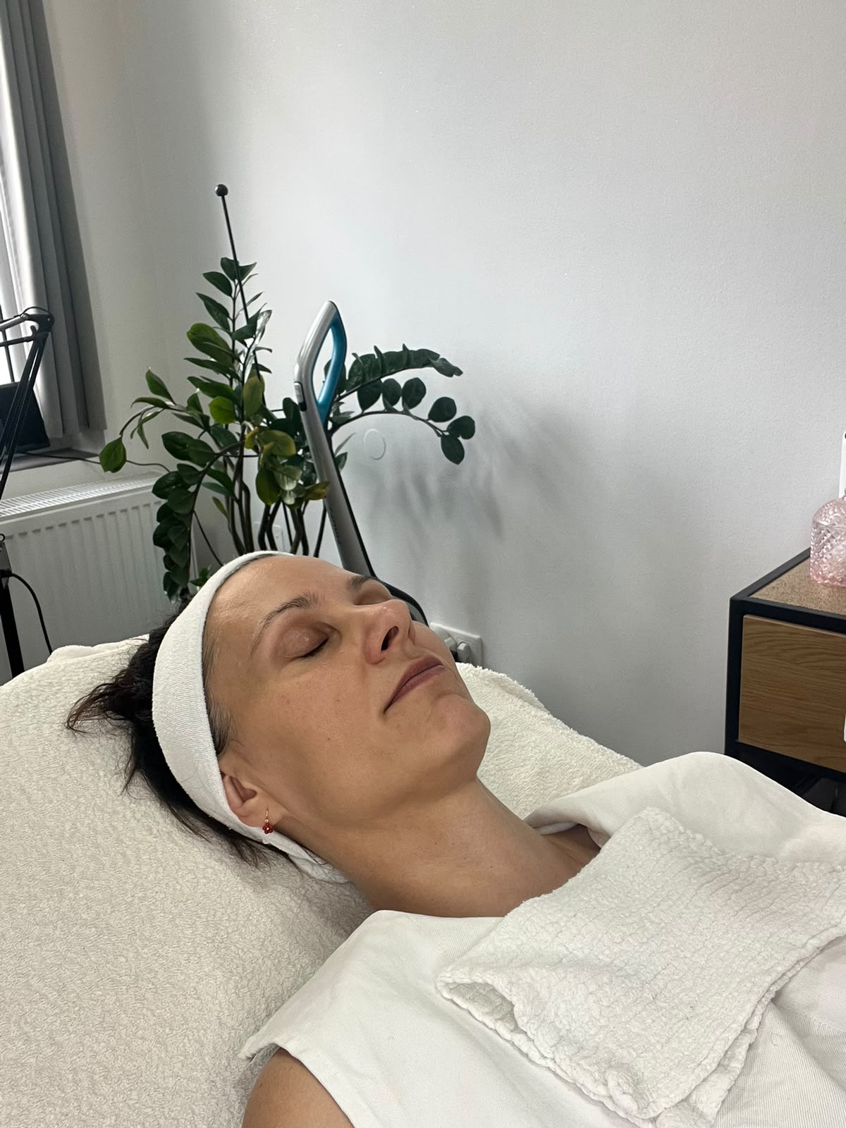 Kozmetikai kezelés eredménye Zalaegerszeg - White Rose Beauty referencia 4