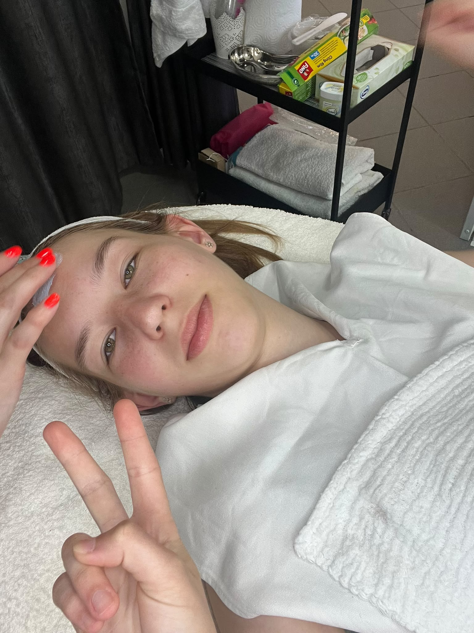 Kozmetikai kezelés eredménye Zalaegerszeg - White Rose Beauty referencia 5