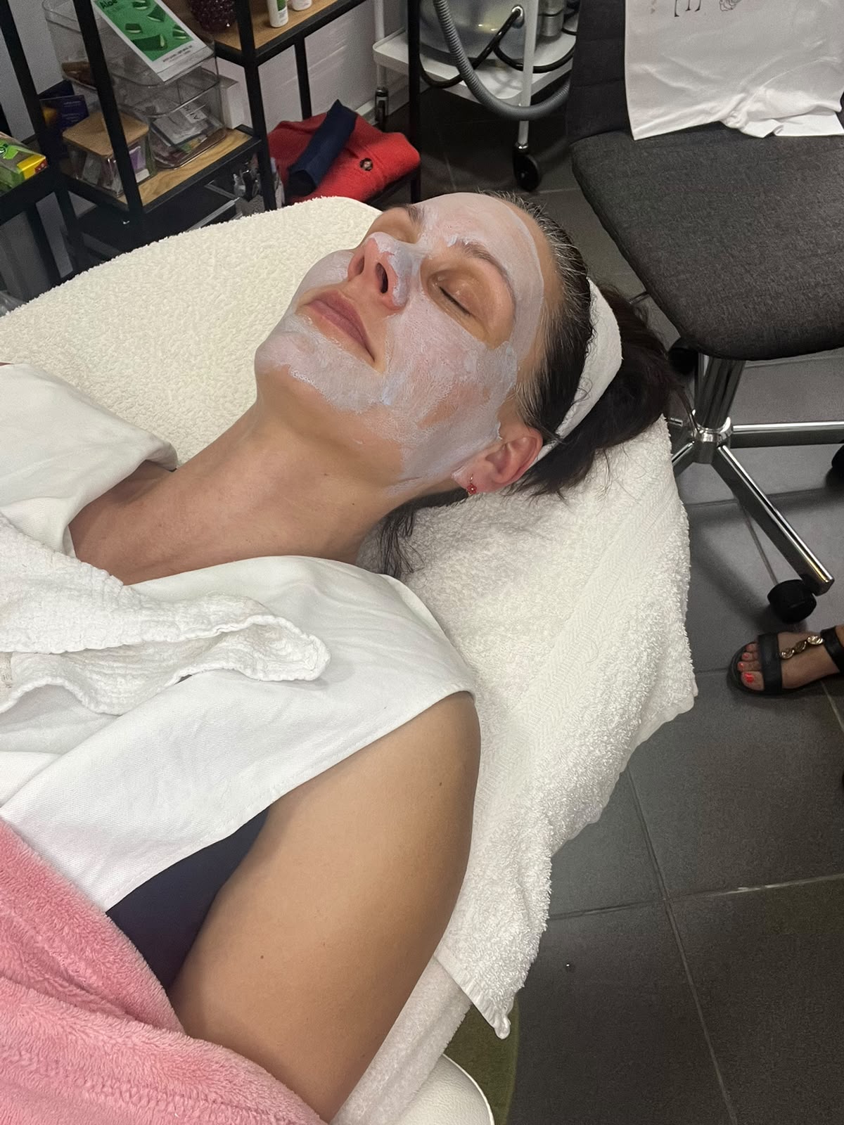 Kozmetikai kezelés eredménye Zalaegerszeg - White Rose Beauty referencia 1