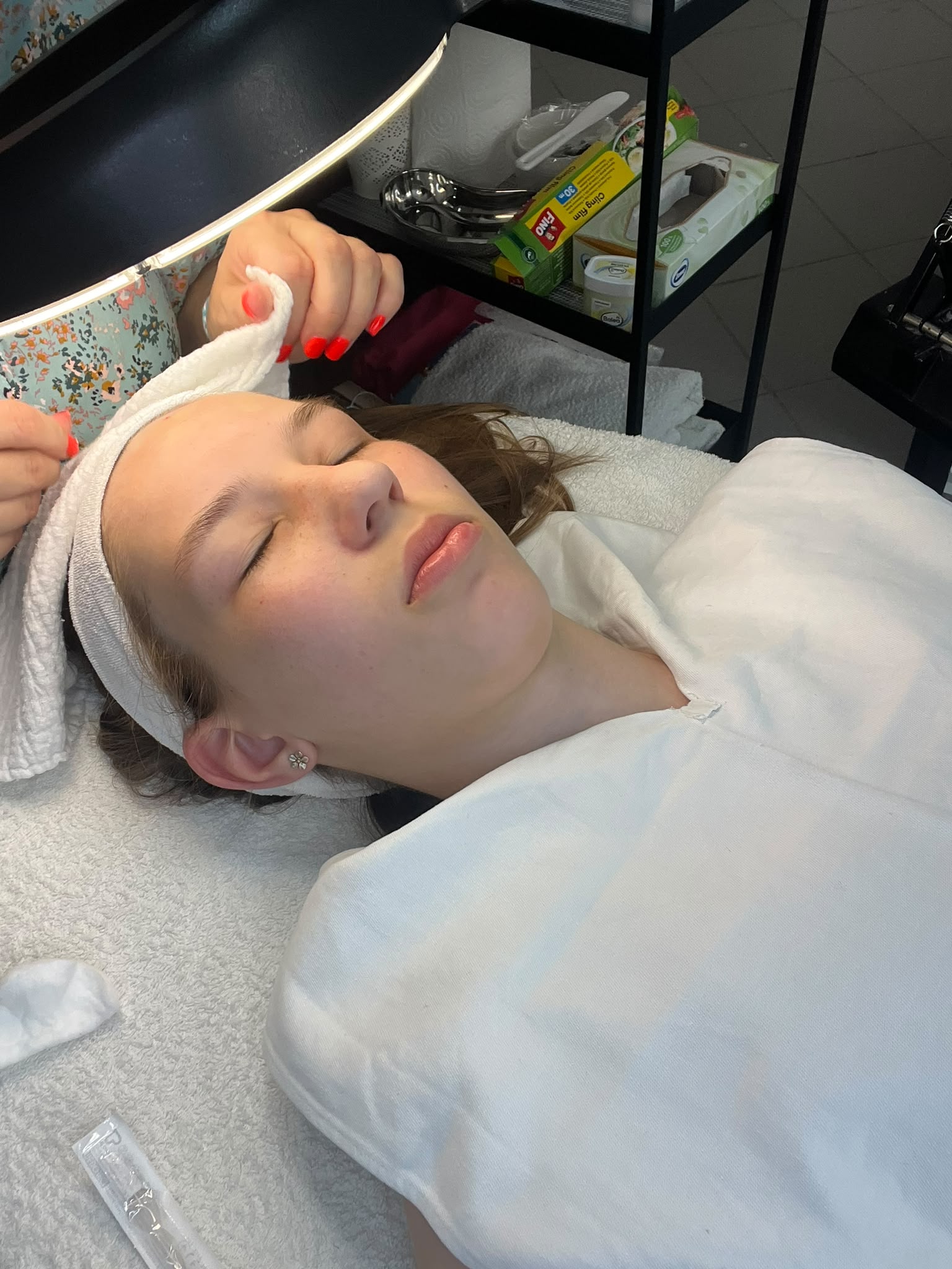 Kozmetikai kezelés eredménye Zalaegerszeg - White Rose Beauty referencia 6
