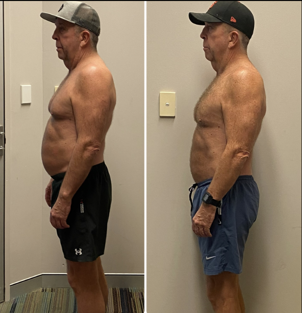 Transformation 10