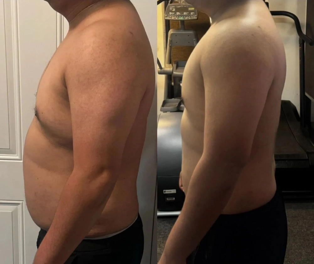 Member Transformation 2