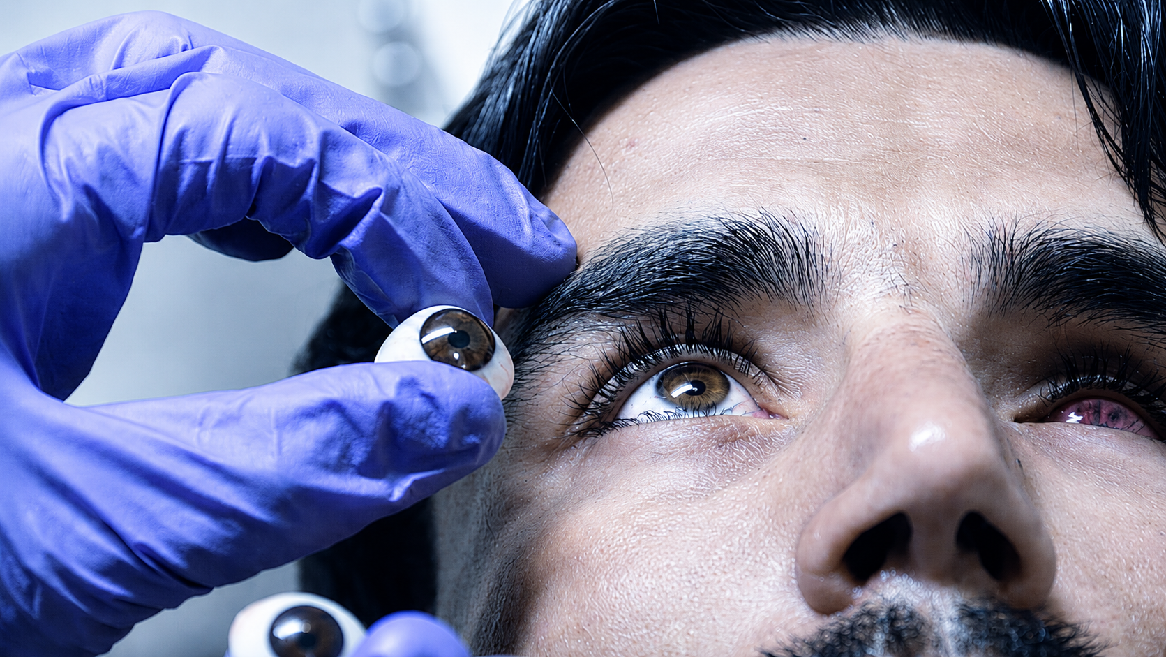 Especialidad en Prótesis Ocular
