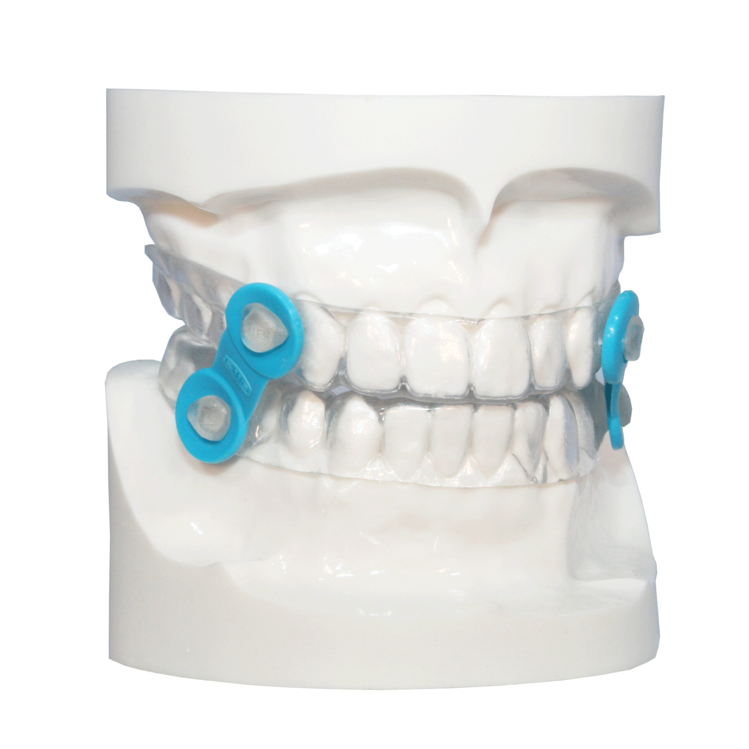 Sleep Apnea Oral Appliance
