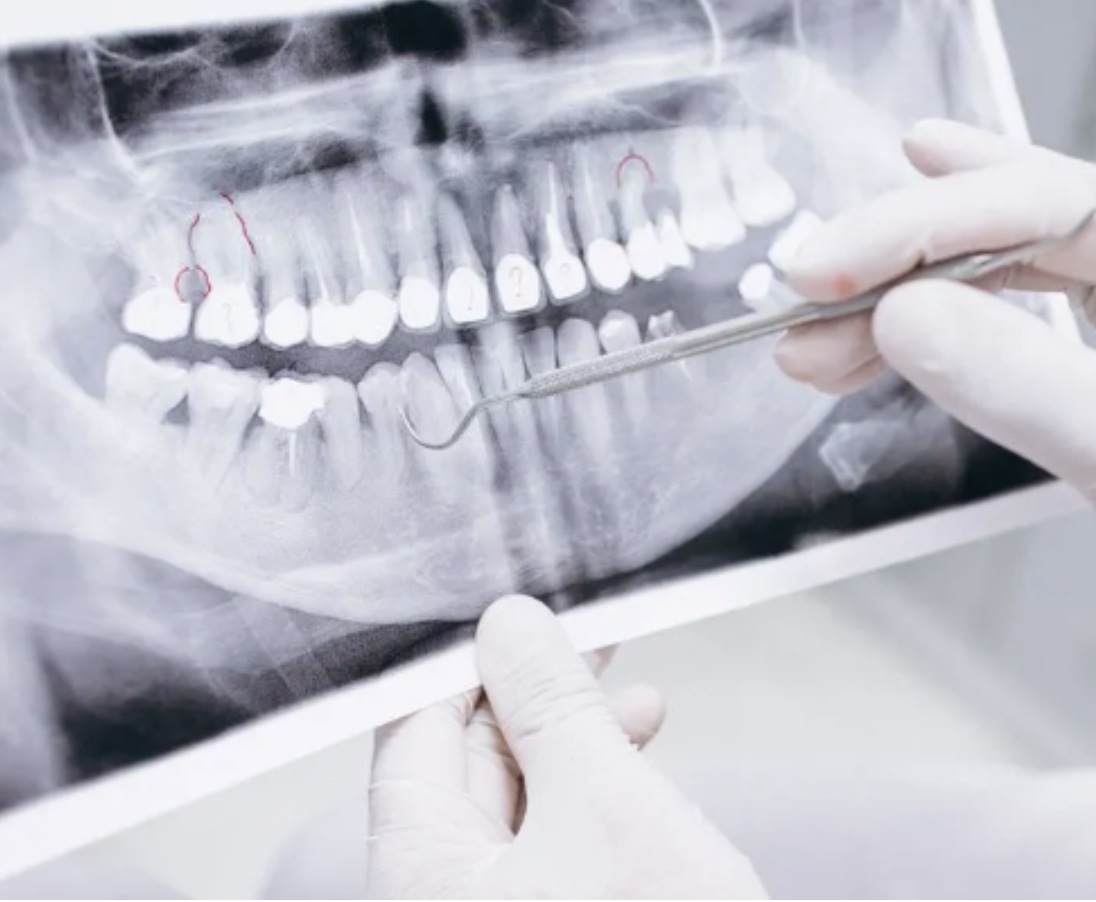 Dentist reviewing digital panoramic dental X-ray at Rogersville Family Dental in Rogersville, MO