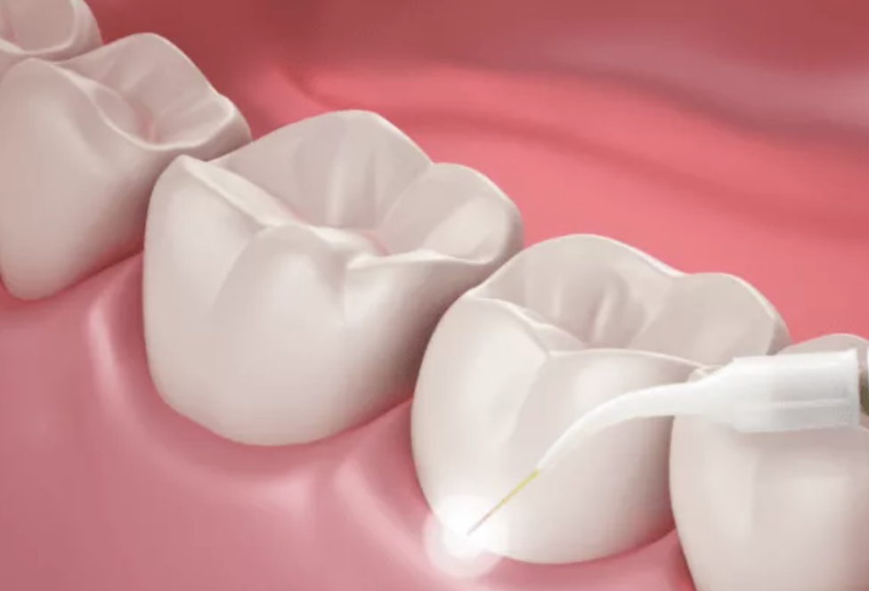 Periodontal Therapy
