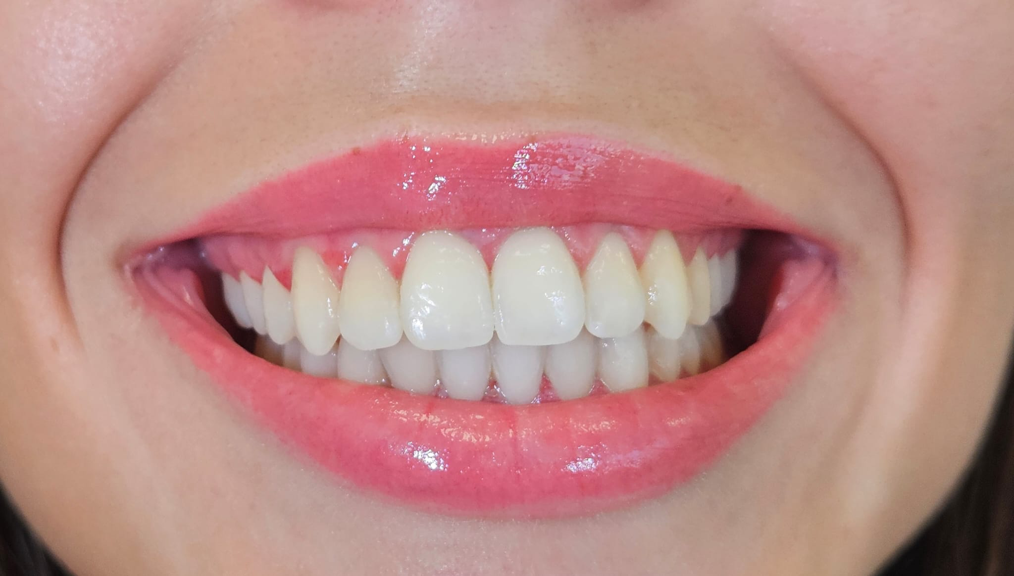 Prirodan i zdrav osmijeh - Dentalna medicina u ordinaciji Damira Mađarić