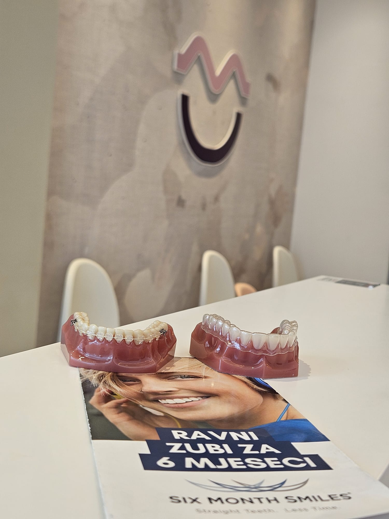 Six Month Smiles model i edukativni materijal u dentalnoj ordinaciji u Čakovcu