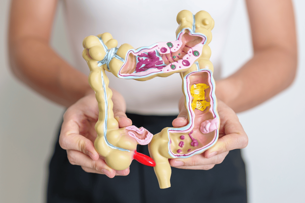 Artículo de nutrición: SIBO: Qué es, síntomas y cómo se trata realmente