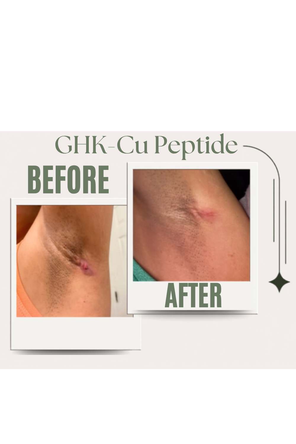 GHK-Cu Peptide Therapy result