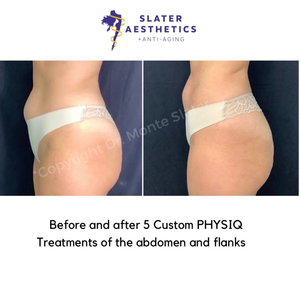 PHYSIQ Before and After 3