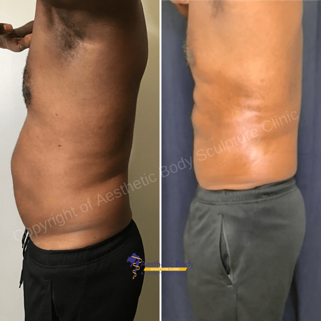 PHYSIQ Before and After 6