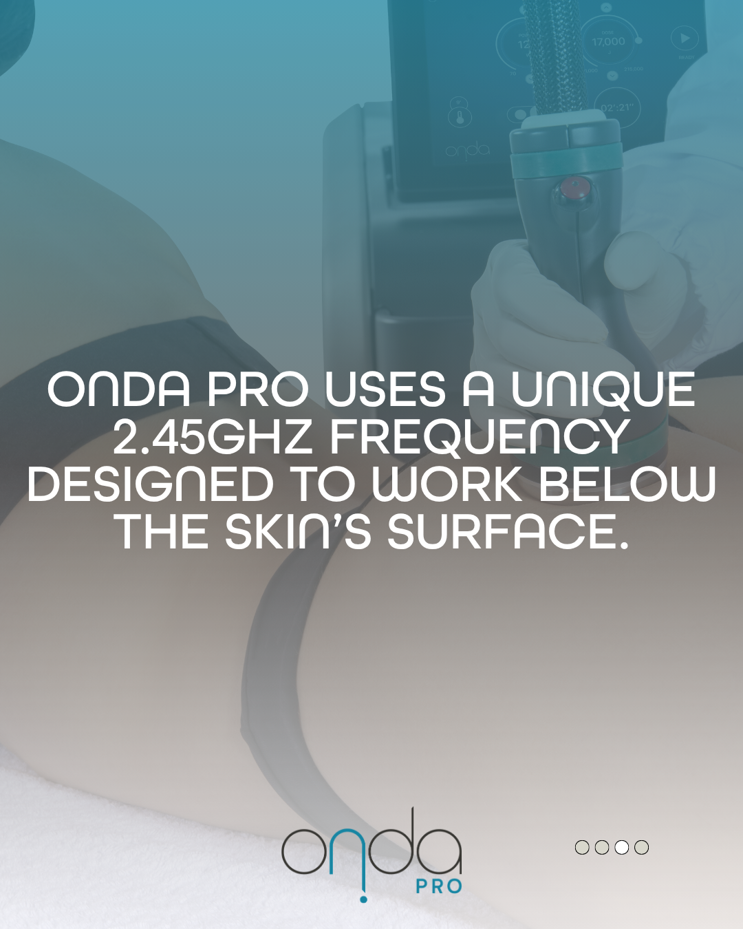 ONDA PRO Coolwaves technology device for cellulite reduction at Slater Aesthetics Atlanta