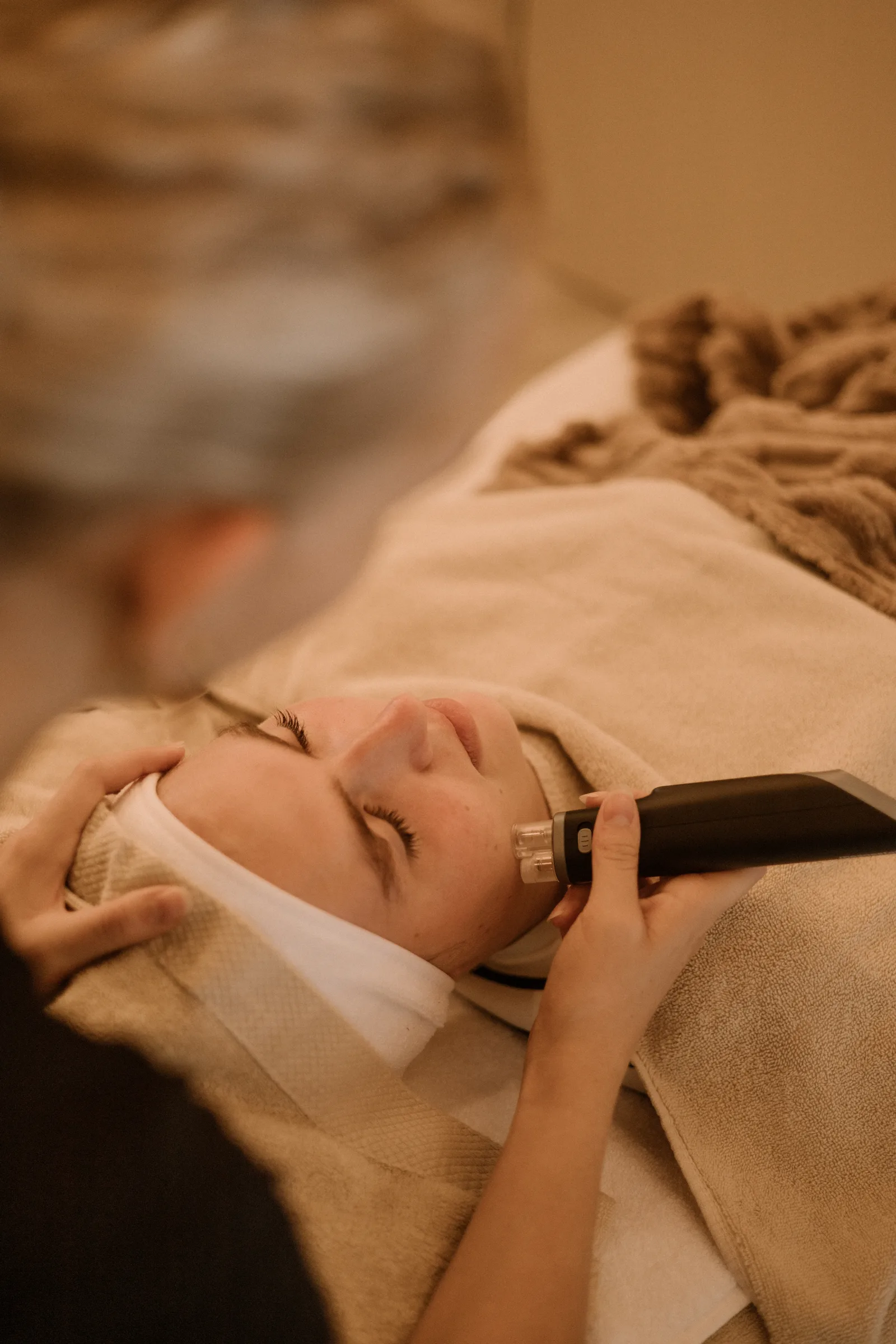 Microneedling voor en na: wat kun je verwachten?