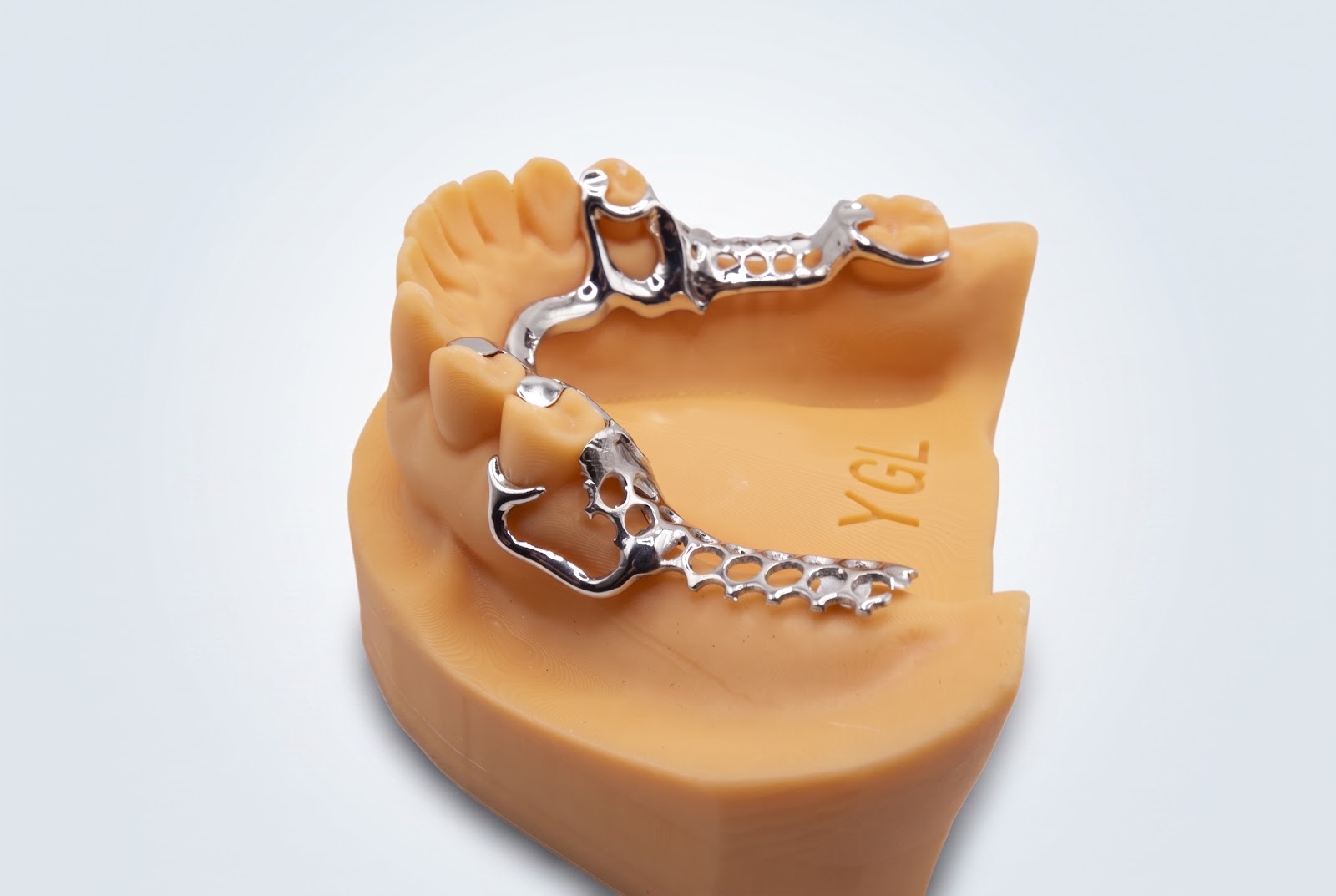 Metal Frame Lower - View 2 | YGL Dental Lab Miami FL