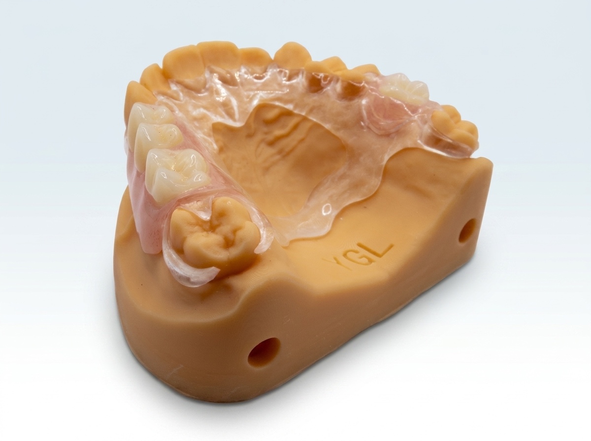 Acrylic Partial with Clear Palatal Design - View 1 | YGL Dental Lab Miami FL