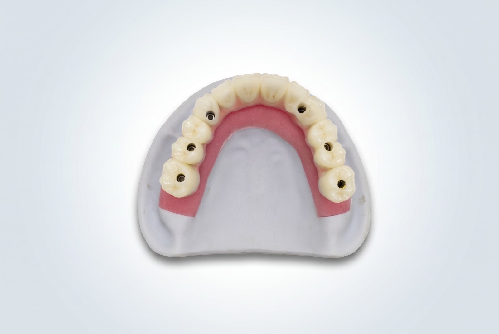 All on 6 With Zirconia - View 1 | YGL Dental Lab Miami FL