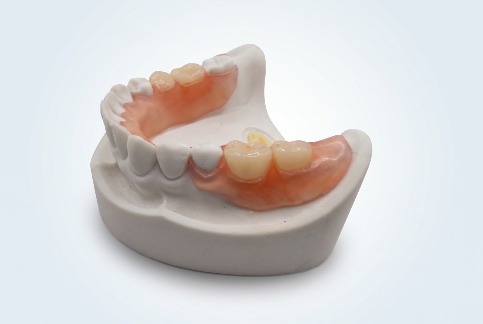 Flex Partial Lower - View 1 | YGL Dental Lab Miami FL