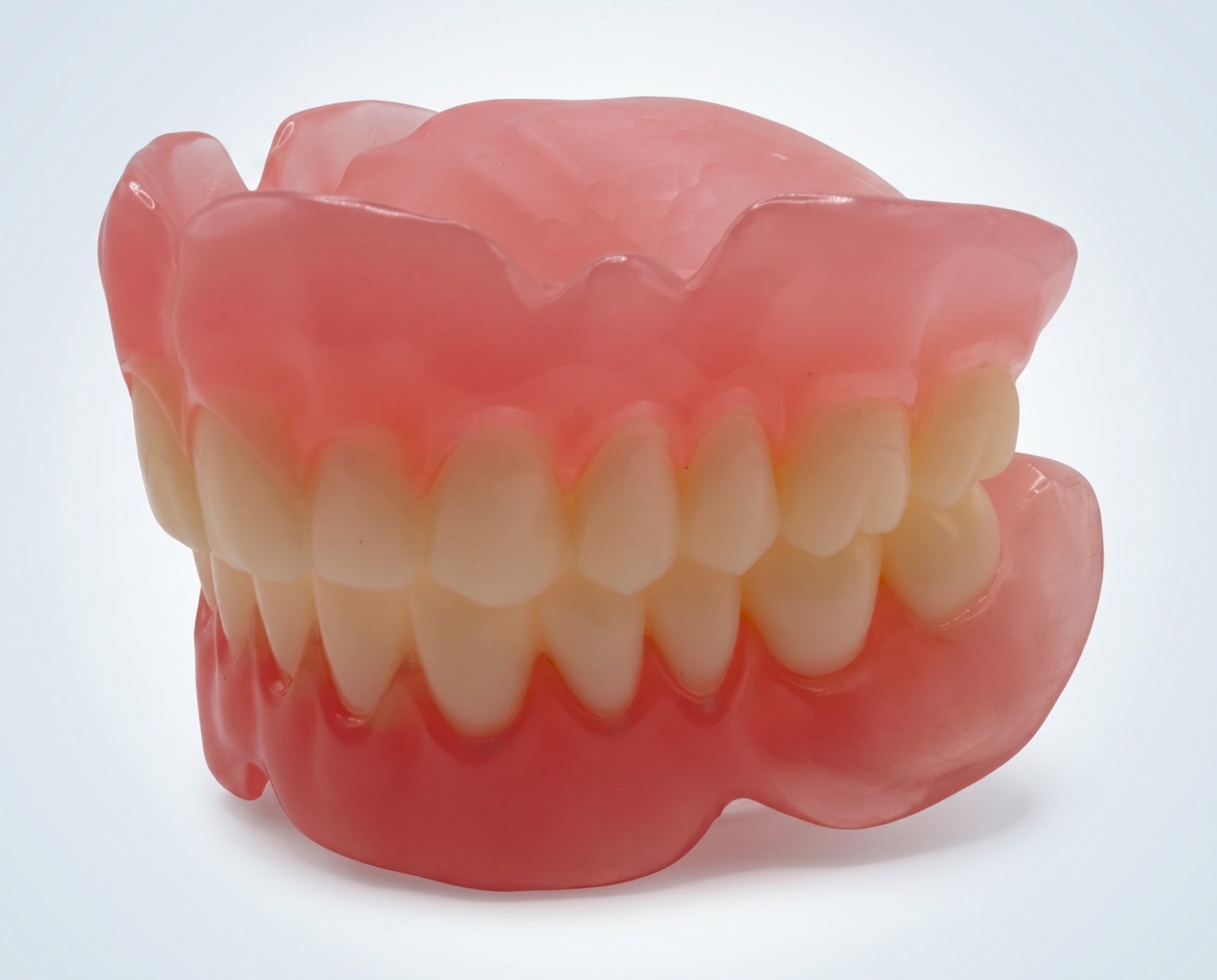 Upper and Lower Digital Full Dentures - View 1 | YGL Dental Lab Miami FL