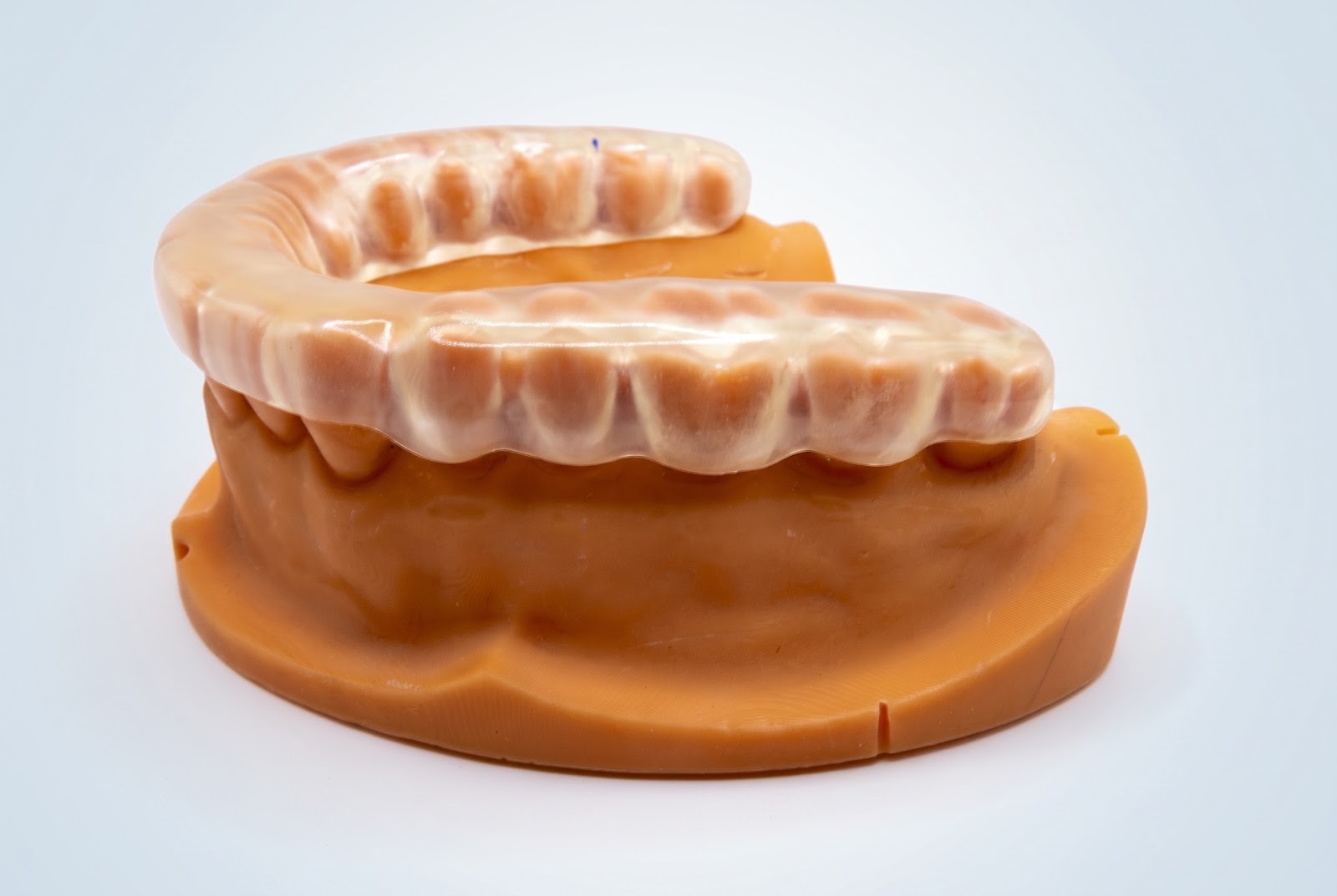 Semi-Soft Night Guard - View 1 | YGL Dental Lab Miami FL