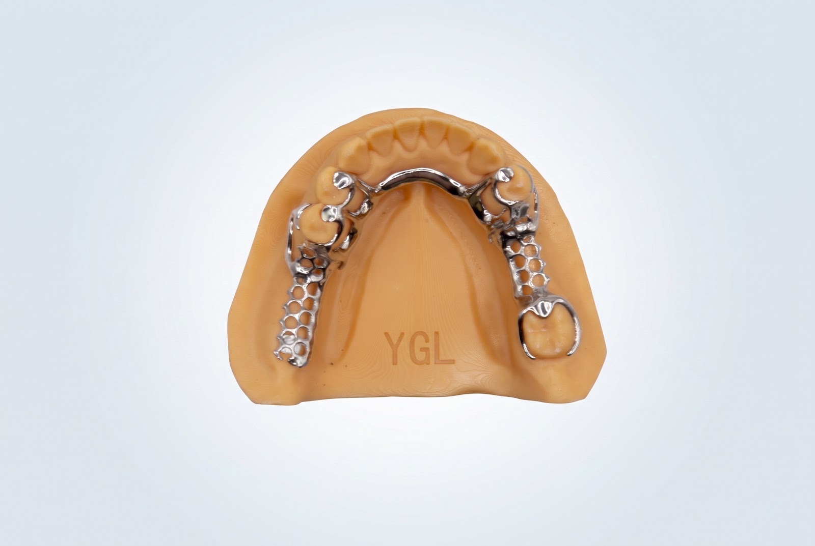 Metal Frame Lower - View 1 | YGL Dental Lab Miami FL