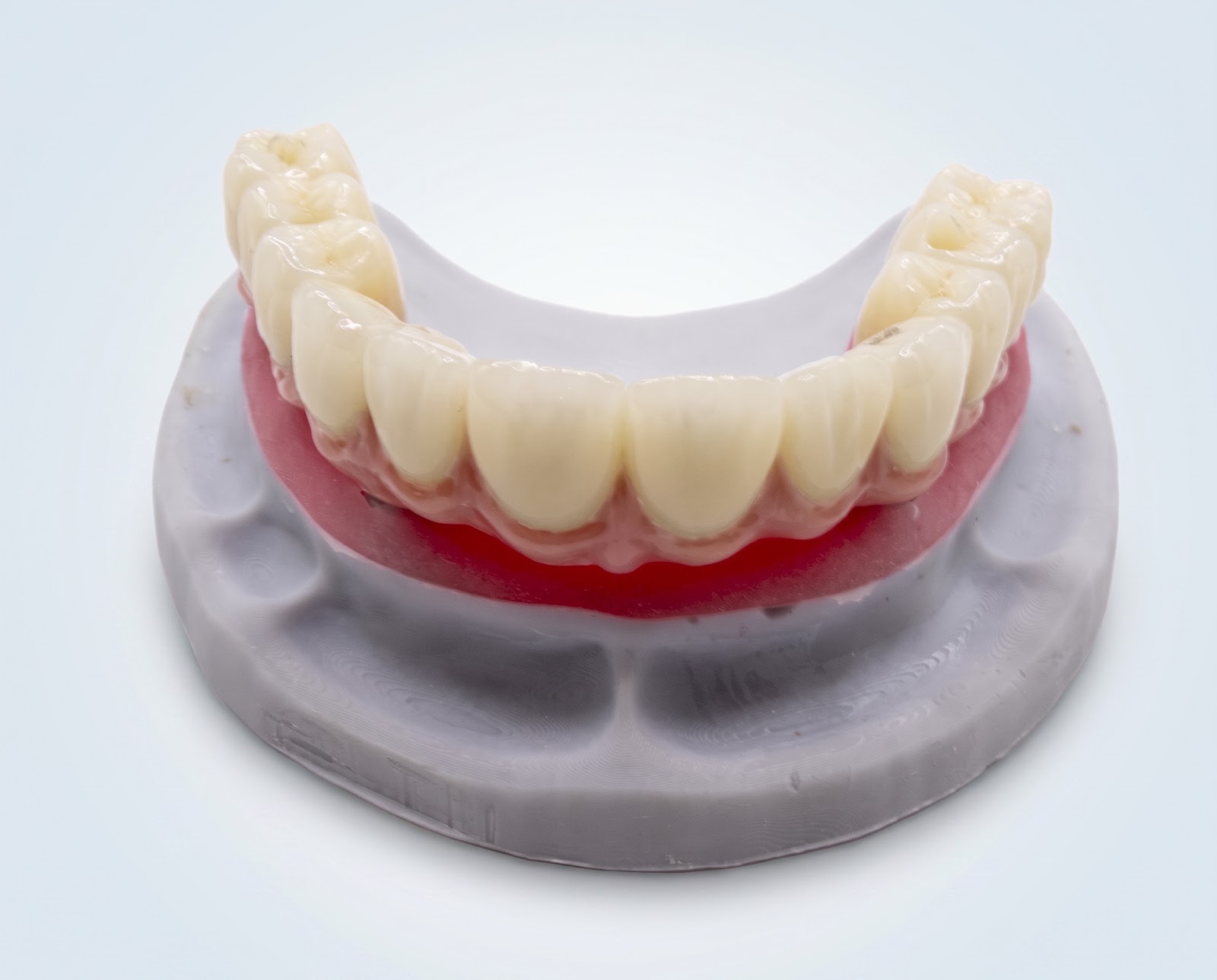 All on 6 With Zirconia - View 3 | YGL Dental Lab Miami FL