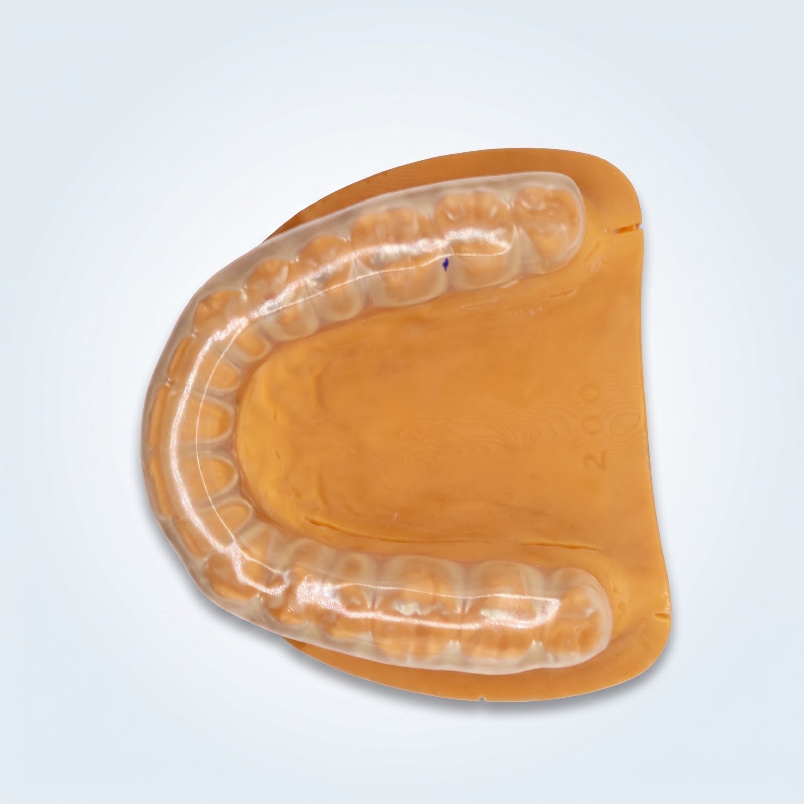 Semi-Soft Night Guard - View 2 | YGL Dental Lab Miami FL