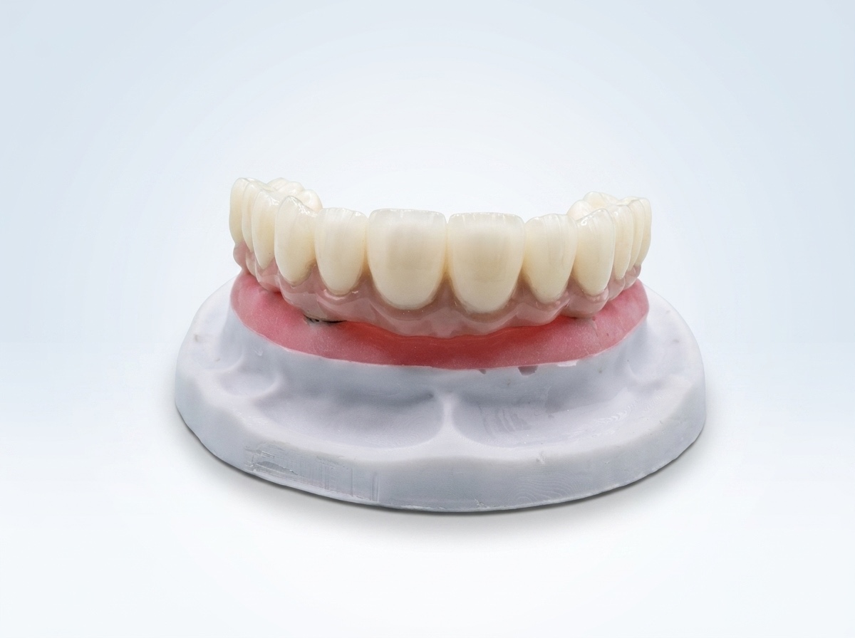 All on 4 With Zirconia - View 1 | YGL Dental Lab Miami FL