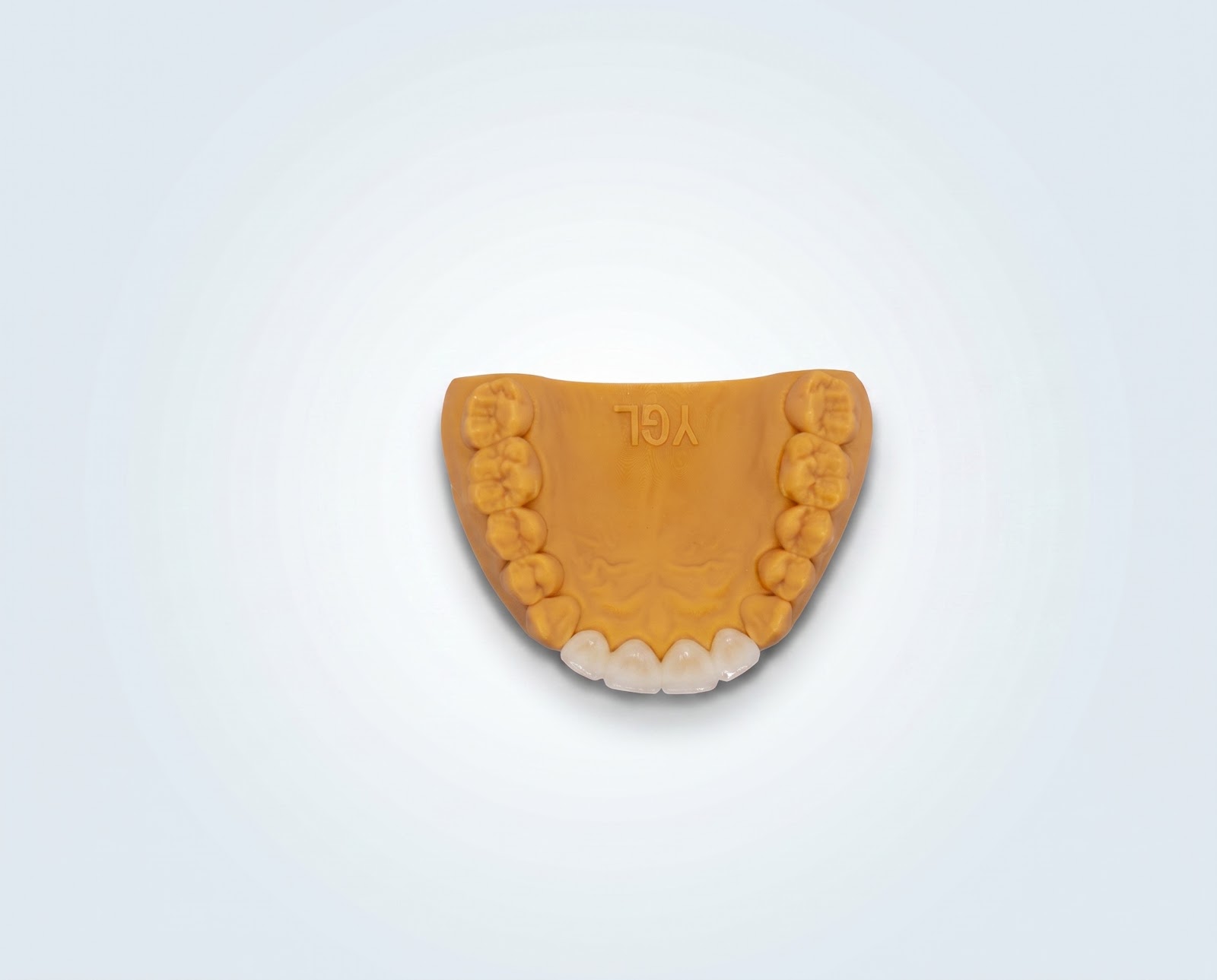 Anteriors Zirconia Crowns - View 2 | YGL Dental Lab Miami FL