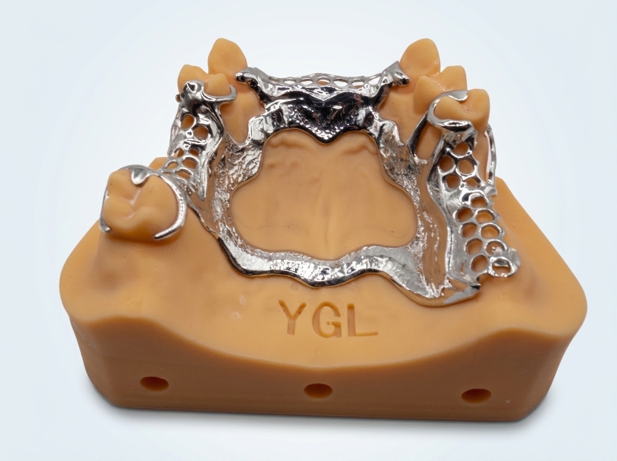 Metal Frame Upper - View 1 | YGL Dental Lab Miami FL