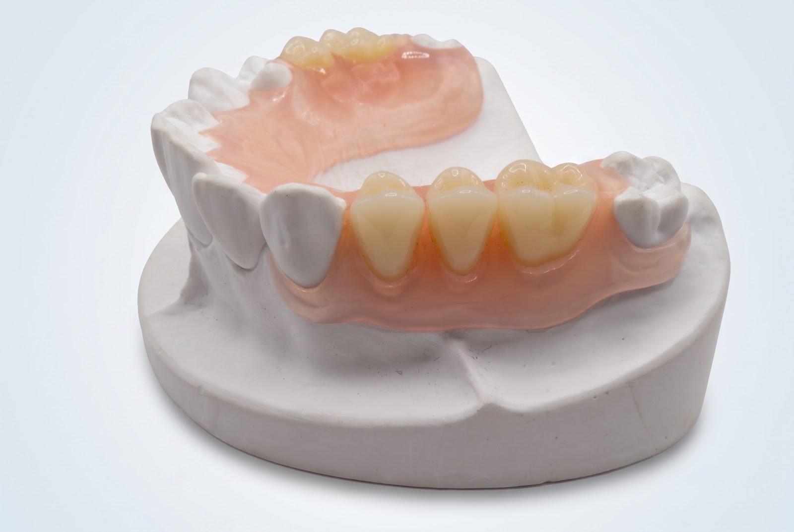 Flex Partial Lower - View 2 | YGL Dental Lab Miami FL