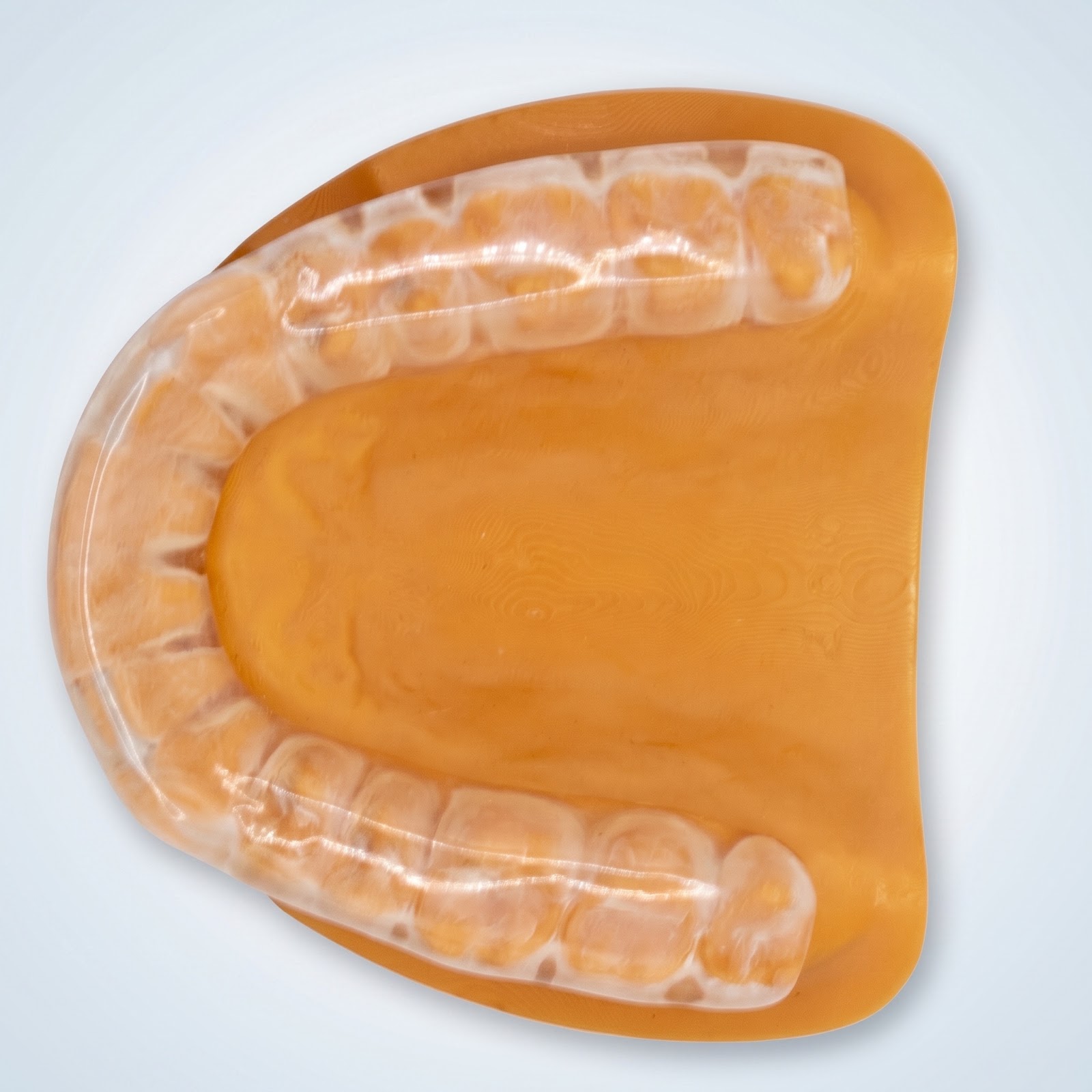 Hard Night Guard - View 1 | YGL Dental Lab Miami FL