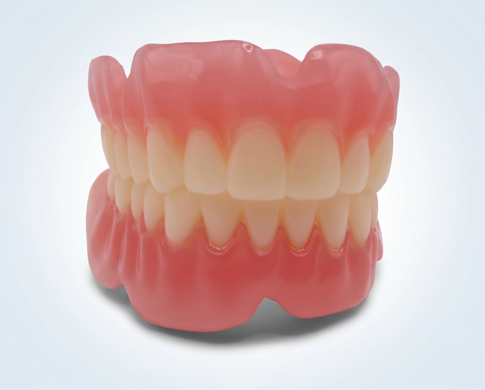 Upper and Lower Digital Full Dentures - View 2 | YGL Dental Lab Miami FL