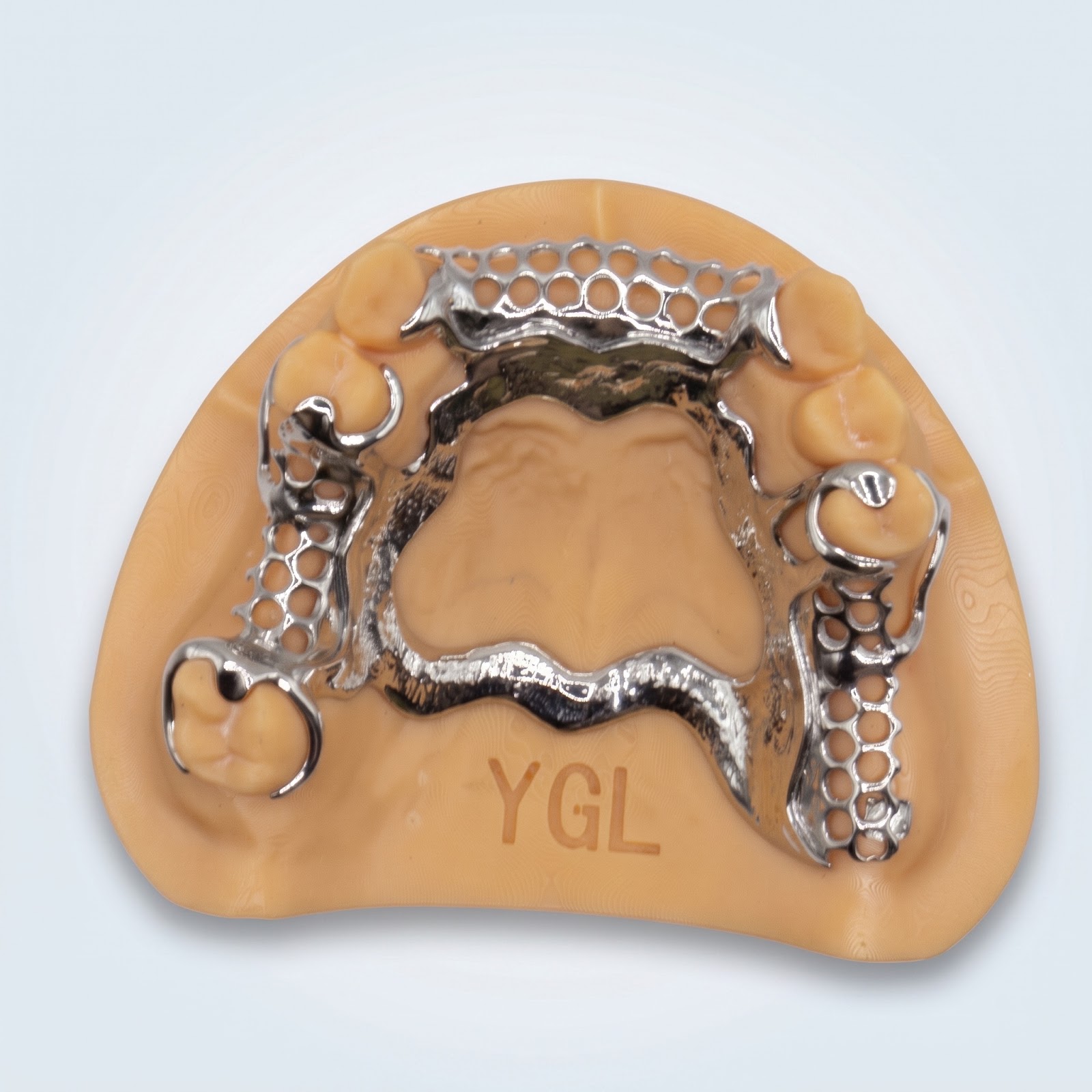 Metal Frame Upper - View 2 | YGL Dental Lab Miami FL