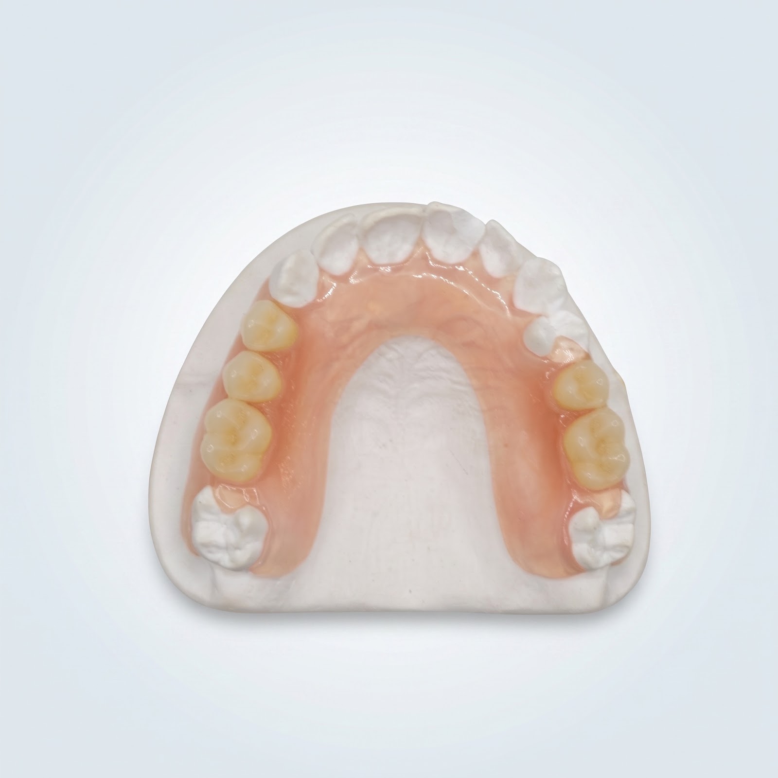 Flex Partial Lower - View 3 | YGL Dental Lab Miami FL