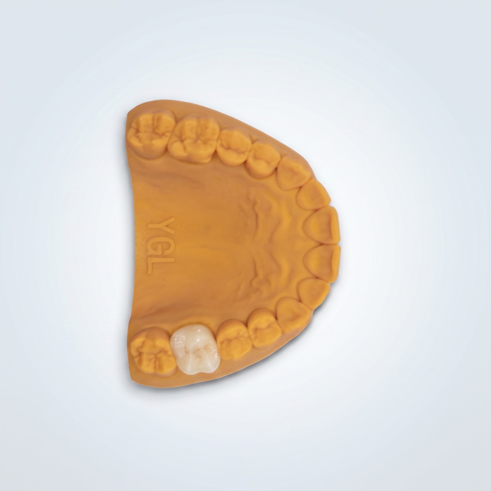 Zirconia Crown - View 2 | YGL Dental Lab Miami FL