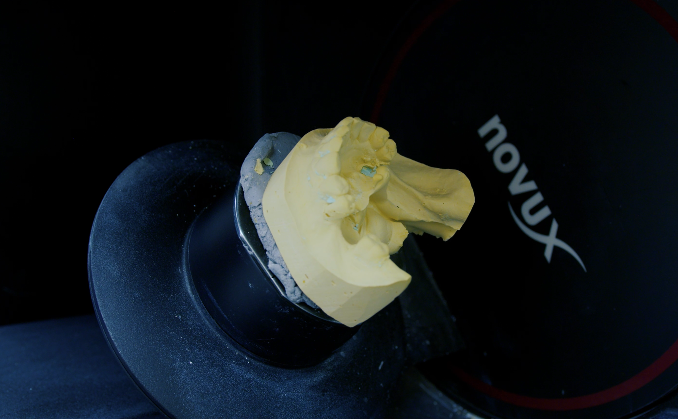 Novux High-Precision Optical Scanner