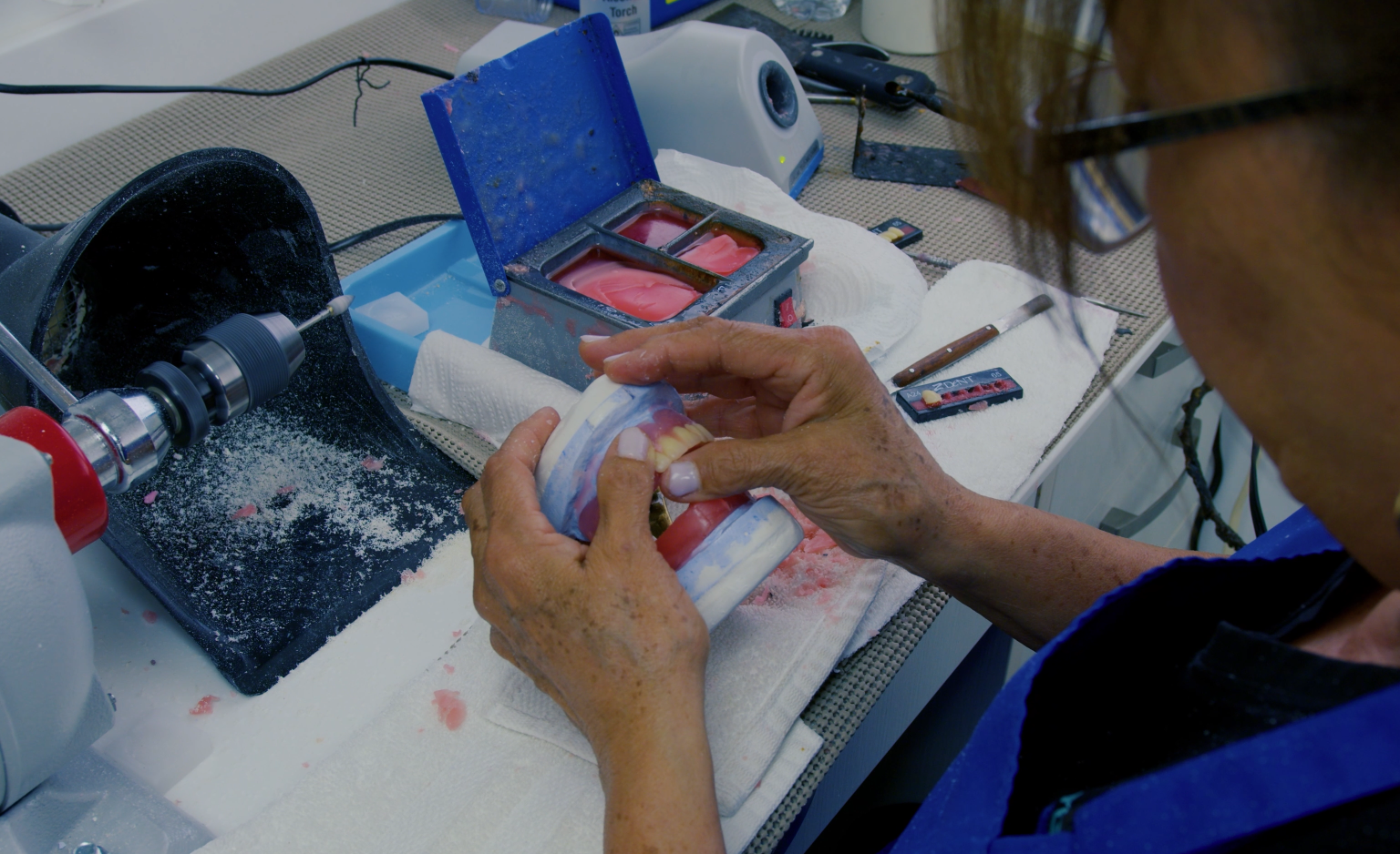 Denture Articulation & Occlusion Check
