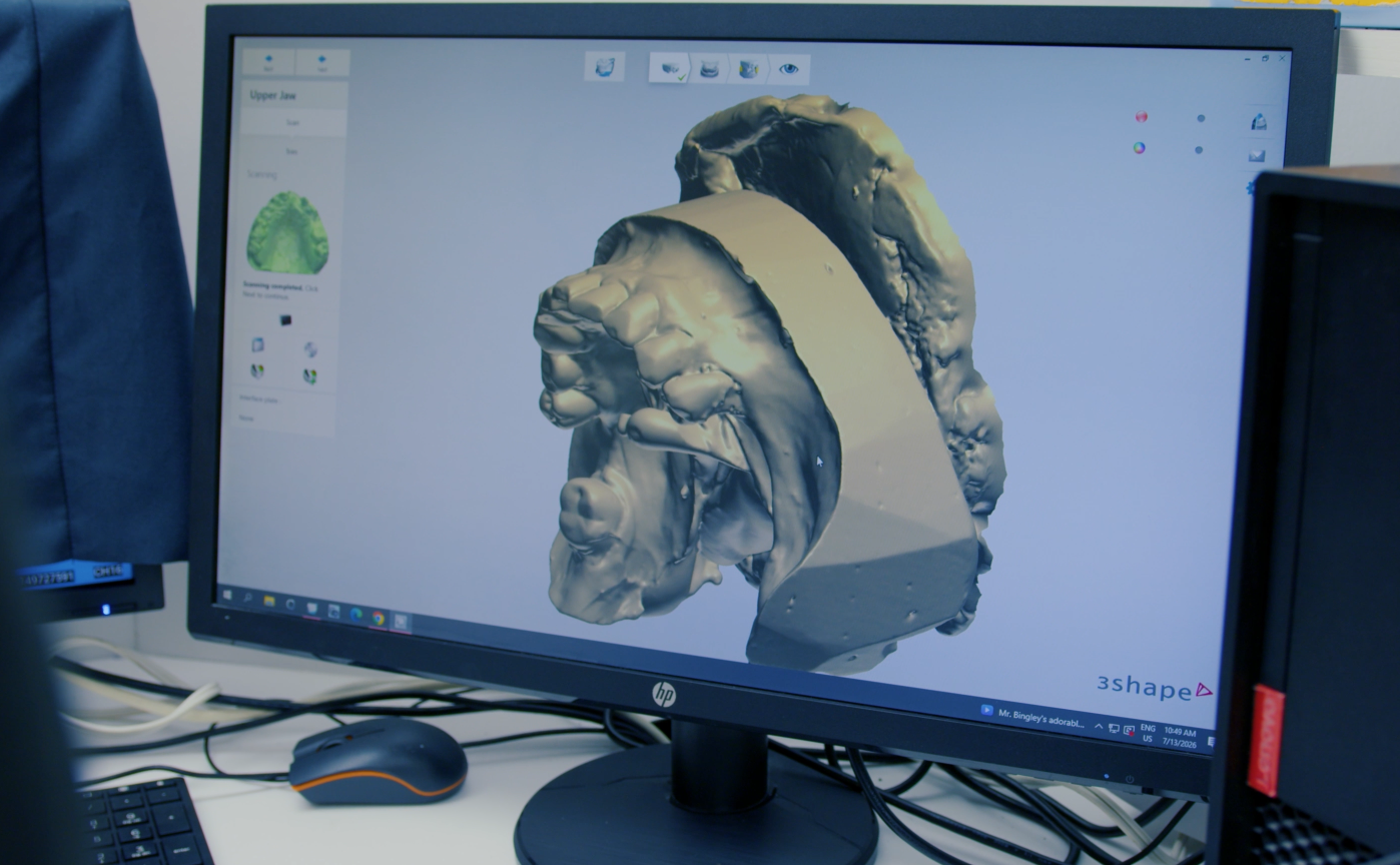 3Shape CAD/CAM Digital Design