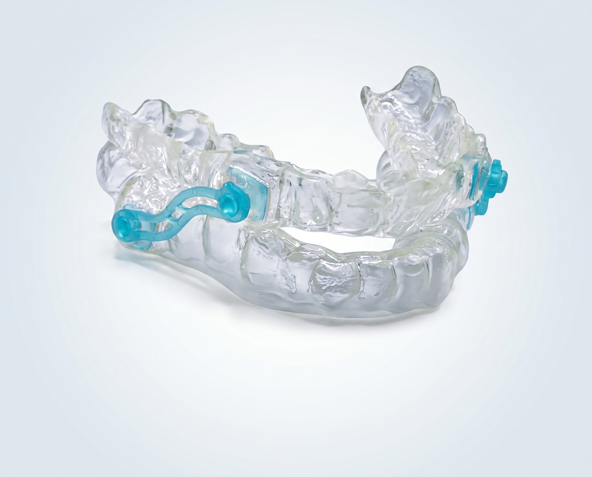 Sleeping Appliance - View 1 | YGL Dental Lab Miami FL