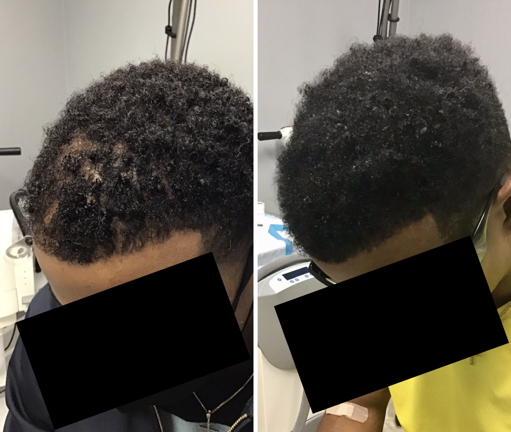 Targeted Patch Restoration