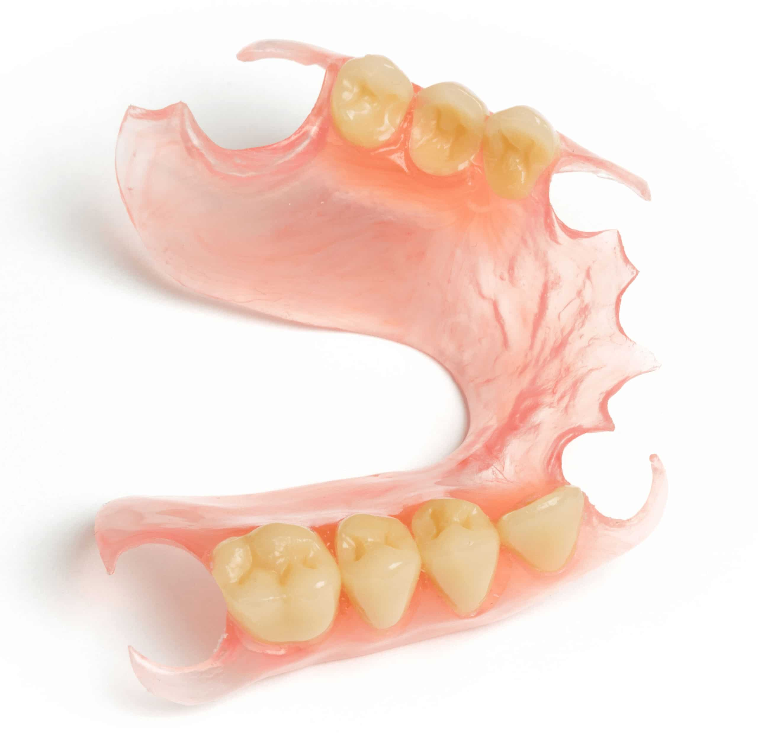 Flexible Partial Dentures (Valplast) treatment at Preston Dentures, Melbourne dental prosthetist clinic