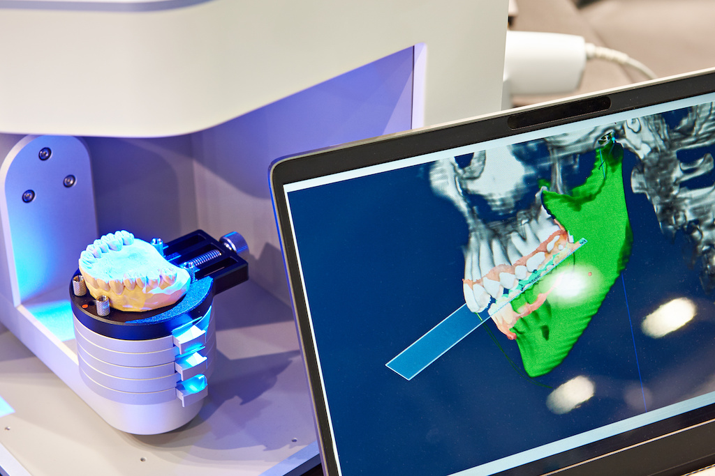 DIGITAL DENTURES denture service at PRESTON DENTURES Melbourne