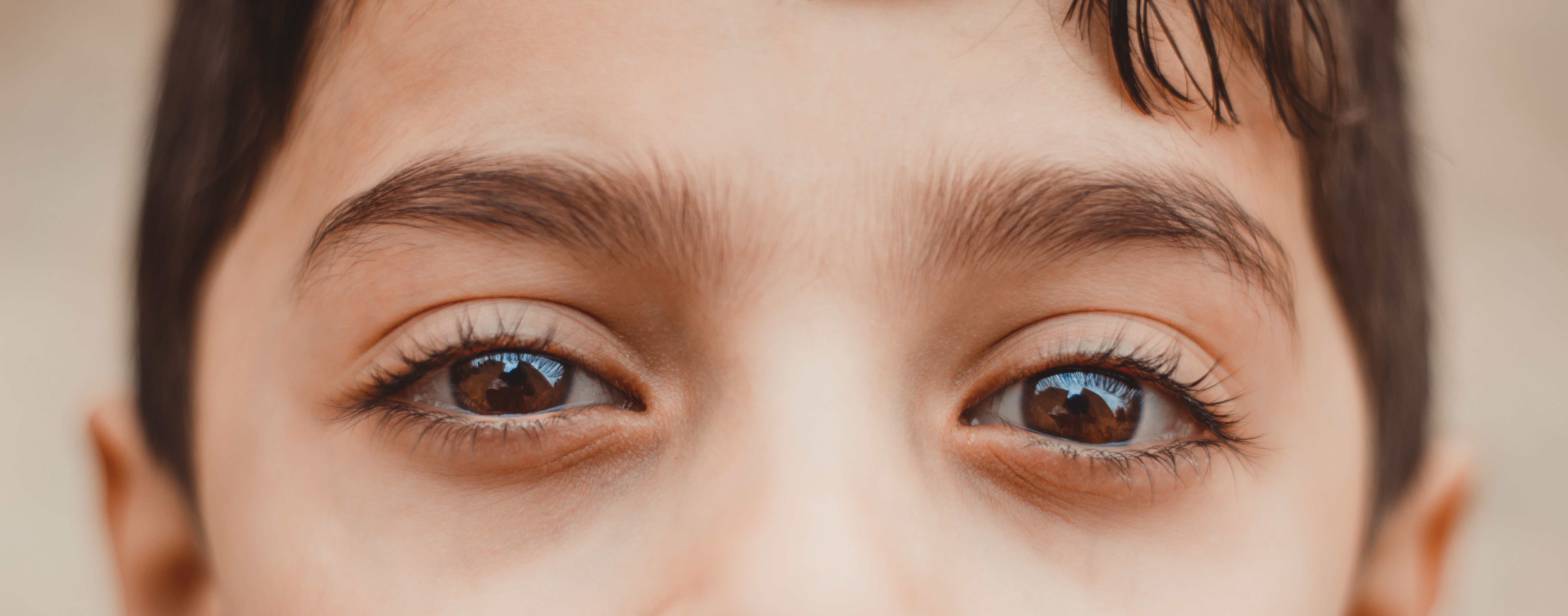 Estrabismo infantil: tratamientos según el tipo de desviación