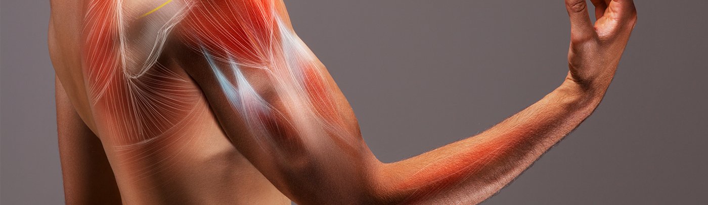 Bicep tendonitis